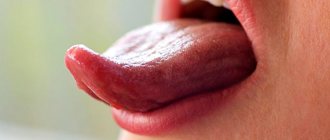 10 types of tongue glossitis with photos that will make everyone wary