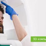 3D томография зубов