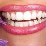 5 видов зубного налета: что означает цвет отложений?