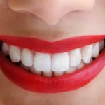 Alternative methods for correcting malocclusion without braces in adults