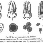 Anatomical features of the upper teeth
