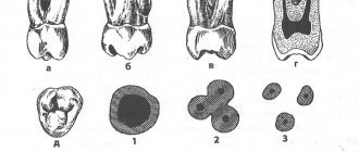 Anatomical features of the upper teeth