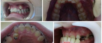 Anomalies of teeth. PHOTO 