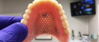 reinforcement of dentures