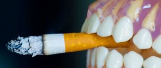 what happens if you smoke while getting a tooth implant?