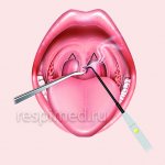 What to do if the tongue in your throat is swollen