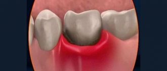 What to do if your teeth are loose and your gums hurt