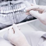 Что может увидеть врач-стоматолог на рентгене