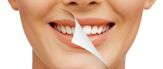 Что нужно знать о реставрации зубов