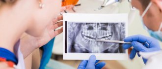 What you need to know before dental implantation