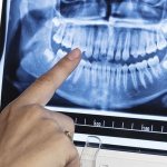 What does a dental orthopantomogram show?