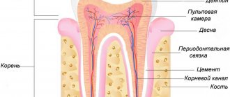 What is caries and its 4 stages