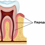 What is periodontology and periodontology?