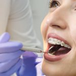 What is tooth separation in dentistry?
