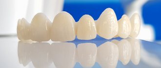 Zirconium crowns: types, pros and cons, cost