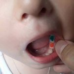 Colored fillings for children