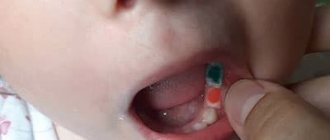 Colored fillings for children