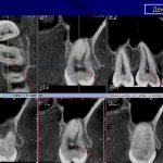 Dentals on X-ray