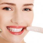 The gums became inflamed after dental treatment