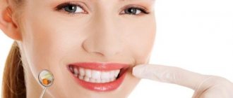 The gums became inflamed after dental treatment