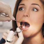 Doctor administers anesthetic - Line of Smile Dentistry