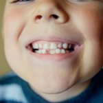 Are there nerves in baby teeth?