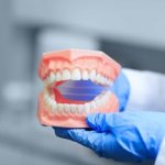 Фиксация зубных протезов