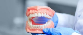 Фиксация зубных протезов