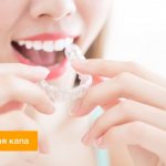 Photo of a girl putting transparent aligners on her teeth