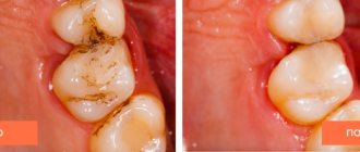 Photo of the patient before and after dental treatment