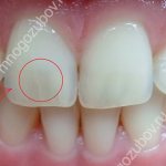 Photo: example of an intact tooth