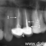 fragment of a panoramic photograph of teeth