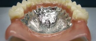 Границы базиса съемного пластиночного зубного протеза