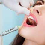инъектор стоматологический для карпульной анестезии