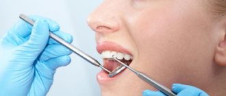 Instrumental visual examination of the oral cavity