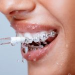 Tools for caring for braces
