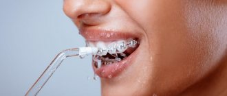 Tools for caring for braces