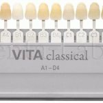 использование шкалы ВИТА при определении цвета зубов