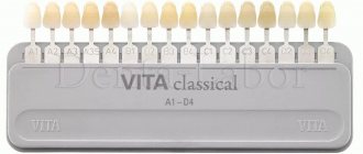использование шкалы ВИТА при определении цвета зубов