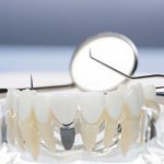 History of dental implantation