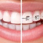 Which doctor should I contact - what is the difference between an orthodontist and an orthopedist in dentistry?
