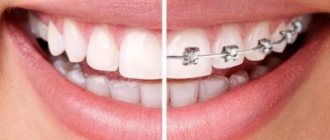 К какому доктору обратиться — чем отличается ортодонт от ортопеда в стоматологии?