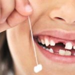 How to painlessly extract a tooth?
