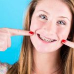 how to make braces at home