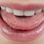 How to deal with sticky saliva?