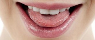 How to deal with sticky saliva?