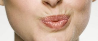 How to remove purse-string wrinkles around the lips