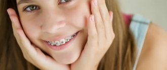 What braces should I install for my child?