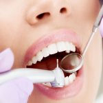 caries causes and prevention