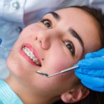 Ceramic or metal braces - Dentistry Line Smiles